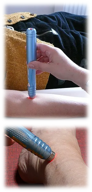 Low-Level-Lasertherapie